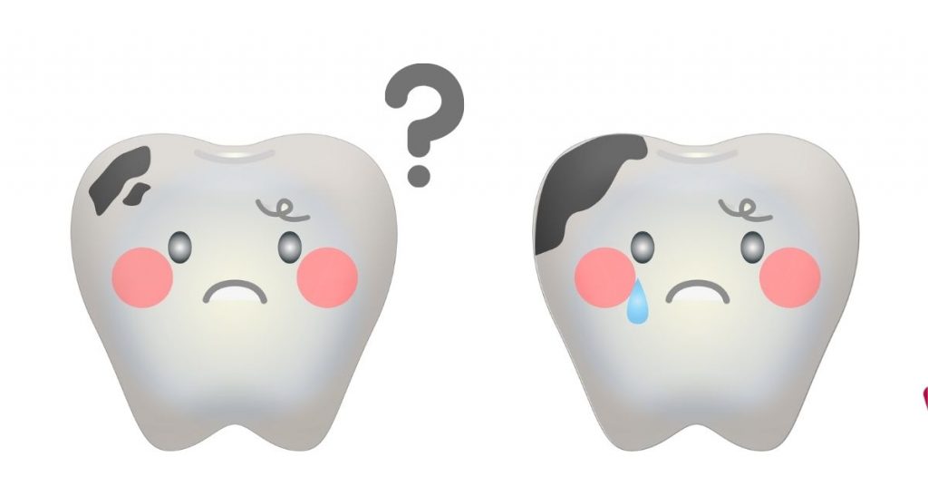 Manchas blancas en las piezas dentales