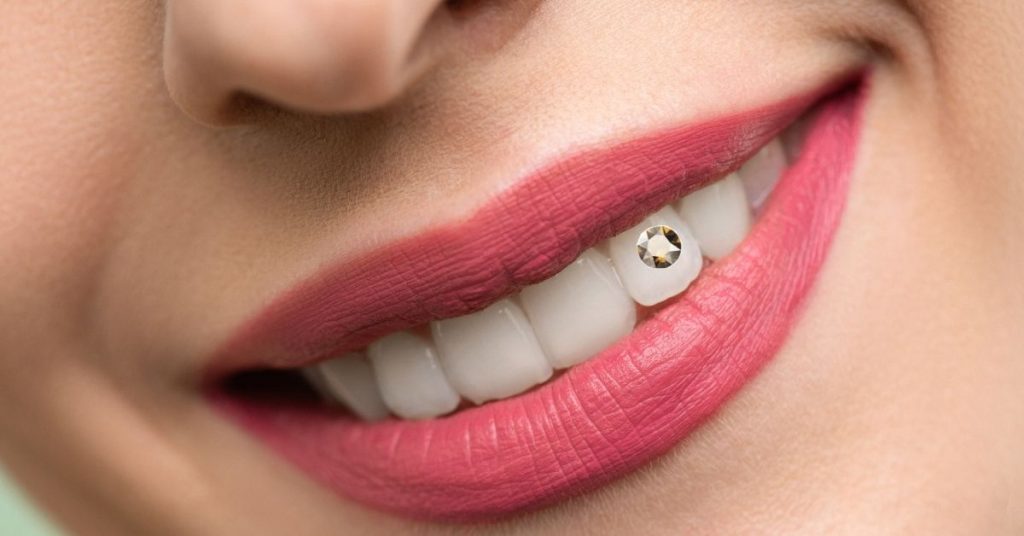 Piercing dental